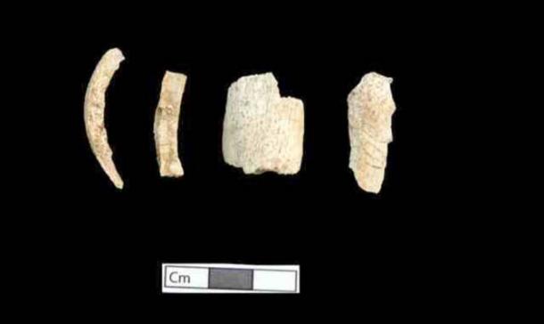 Person 5 bones (Amphipolis tomb) that have undergone the influence of high temperature, after burning. 